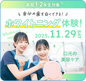ホワイトニング体験！